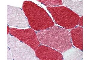 MYL6 antibody was used for immunohistochemistry at a concentration of 4-8 ug/ml.