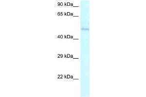 Western Blot showing AMBN antibody used at a concentration of 1 ug/ml against Jurkat Cell Lysate