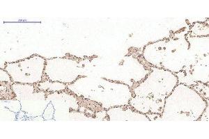 Immunohistochemistry of paraffin-embedded Human lung tissue using Desmin Monoclonal Antibody at dilution of 1:200. (Desmin 抗体)