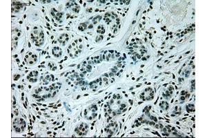 Immunohistochemical staining of paraffin-embedded breast tissue using anti-GAD1 mouse monoclonal antibody. (GAD 抗体)