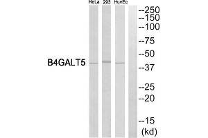 Western blot analysis of extracts from HeLa cells, HuvEc cells and 293 cells, using B4GALT5 antibody. (B4GALT5 抗体  (C-Term))