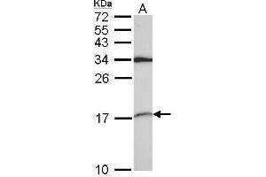 WB Image Sample (30 ug of whole cell lysate) A: A549 15% SDS PAGE antibody diluted at 1:1000 (SNRPD2 抗体)