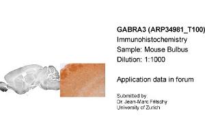 Immunohistochemistry (IHC) image for anti-gamma-aminobutyric Acid (GABA) A Receptor, alpha 3 (GABRA3) (Middle Region) antibody (ABIN2776110)