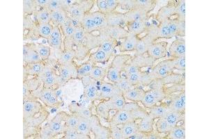 Immunohistochemistry of paraffin-embedded Mouse liver using ASGR1 Polyclonal Antibody at dilution of 1:100 (40x lens). (Asialoglycoprotein Receptor 1 抗体)