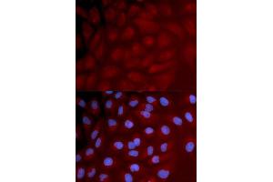 Immunofluorescence analysis of U2OS cell using IRF3 antibody. (IRF3 抗体)