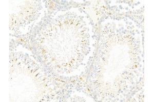 ABIN7094885 and ABIN7098938 at 1/100 staining Rat testis tissue by IHC-P. (LIF 抗体  (N-Term))