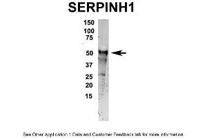 IP Suggested Anti-SERPINH1 Antibody Positive Control: NT2 CELL/BRAIN TISSUE (SERPINH1 抗体  (C-Term))