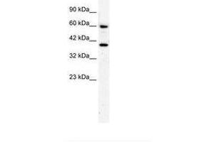Image no. 2 for anti-RAR-Related Orphan Receptor A (RORA) (AA 50-99) antibody (ABIN202757)