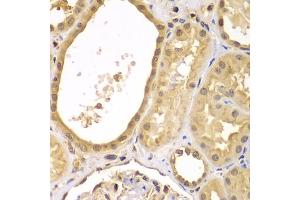 Immunohistochemistry of paraffin-embedded human kidney using XIAP antibody (ABIN5974139) at dilution of 1/100 (40x lens). (XIAP 抗体)