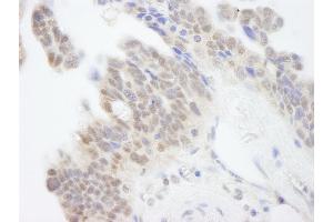 Immunohistochemistry (IHC) image for anti-Abl-Interactor 1 (ABI1) (AA 325-375) antibody (ABIN7448400)