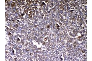 IHC testing of FFPE mouse liver tissue with VDBP antibody at 1ug/ml. (Vitamin D-Binding Protein 抗体)