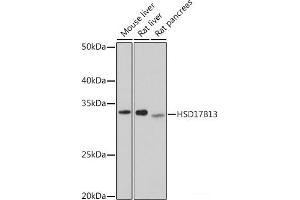 Western blot analysis of extracts of various cell lines using HSD17B13 Polyclonal Antibody at dilution of 1:1000. (HSD17B13 抗体)