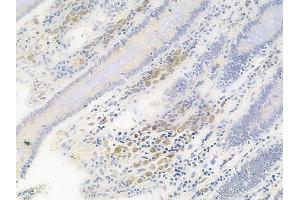 ABIN6256423 and ABIN6267512 at 1/100 staining human normal colon tissue by IHC-P. (STAT5A 抗体  (pSer780))