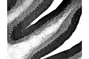 Adult rat cerebellar immunohistochemistry.