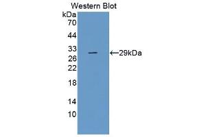 Detection of Recombinant TLR5, Human using Monoclonal Antibody to Toll Like Receptor 5 (TLR5) (TLR5 抗体  (AA 693-858))