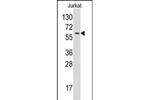 Western blot analysis of anti-YARS Pab (ABIN391838 and ABIN2841677) in Jurkat cell line lysates (35 μg/lane). (YARS 抗体  (N-Term))