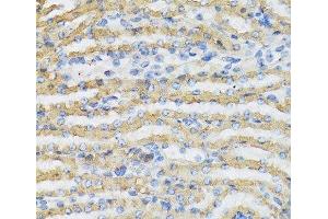 Immunohistochemistry of paraffin-embedded Mouse kidney using C4BPB Polyclonal Antibody at dilution of 1:100 (40x lens). (C4BPB 抗体)