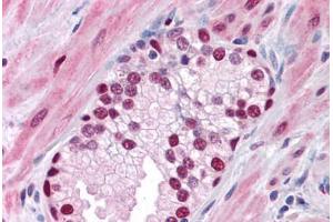 Human Prostate: Formalin-Fixed, Paraffin-Embedded (FFPE) (SOX9 抗体  (AA 400-510))