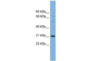 WB Suggested Anti-SLCO1B1 Antibody Titration: 0. (SLCO1B1 抗体  (Middle Region))