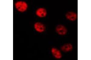 Immunofluorescence (fixed cells) (IF/ICC) image for anti-Histone Deacetylase 8 (HDAC8) (pSer39) antibody (ABIN6255291)