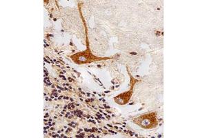 Immunohistochemical staining of paraffin-embedded human cerebellum section reacted with PPT1 monoclonal antibody  at 1:25 dilution. (PPT1 抗体)