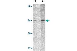 Western blot analysis of HAX1 in human brain tissue lysate with HAX1 polyclonal antibody  at (Lane 1) 1 and (Lane 2) 2 ug/mL . (HAX1 抗体  (N-Term))