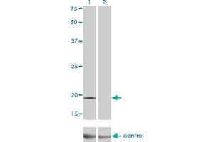 Western blot analysis of DCTD over-expressed 293 cell line, cotransfected with DCTD Validated Chimera RNAi (Lane 2) or non-transfected control (Lane 1).