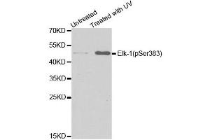 Western blot analysis of extracts from HT29 cells untreated or treated with UV, using Phospho-ELK1-S383 antibody (ABIN5969890). (ELK1 抗体  (pSer383))