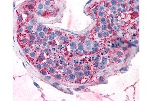 Immunohistochemistry (IHC) image for anti-G Protein-Coupled Receptor, Family C, Group 5, Member A (GPRC5A) (Transmembrane Domain) antibody (ABIN1048909)