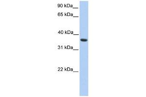 MAGEA4 antibody used at 1 ug/ml to detect target protein. (MAGEA4 抗体  (C-Term))