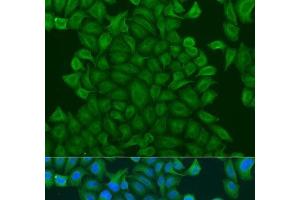 Immunofluorescence analysis of U2OS cells using GSTM3 Polyclonal Antibody at dilution of 1:100. (GSTM3 抗体)