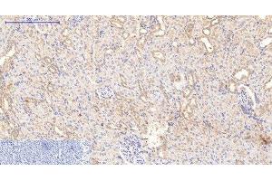 Immunohistochemistry (Paraffin-embedded Sections) (IHC (p)) image for anti-Collagen, Type I, alpha 1 (COL1A1) antibody (ABIN7250383)