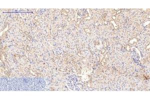 Immunohistochemistry of paraffin-embedded Rat kidney tissue using COL1A1 Monoclonal Antibody at dilution of 1:200. (COL1A1 抗体)