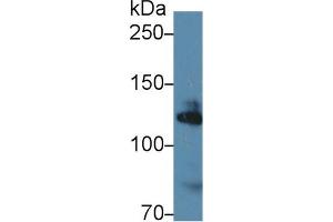 Western Blot; Sample: Human K562 cell lysate; Primary Ab: 1µg/ml Rabbit Anti-Mouse ADD1 Antibody Second Ab: 0. (alpha Adducin 抗体  (AA 388-560))