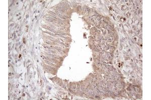 Immunohistochemistry (IHC) image for anti-Amelotin (AMTN) antibody (ABIN2716039) (Amelotin 抗体)