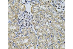 Immunohistochemistry of paraffin-embedded Rat kidney using AP2A1 Polyclonal Antibody at dilution of 1:100 (40x lens). (alpha Adaptin 抗体)