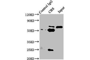 Immunoprecipitating CBS in Hela whole cell lysate Lane 1: Rabbit control IgG instead of ABIN7148965 in Hela whole cell lysate. (CBS 抗体  (AA 1-413))