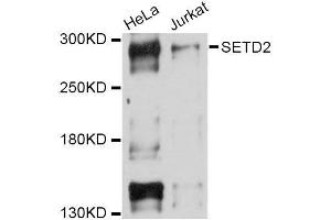 Western blot analysis of extracts of various cell lines, using SETD2 Antibody. (SETD2 抗体  (AA 803-1103))