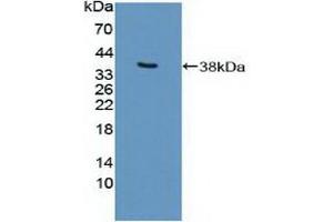 Detection of Recombinant EP300, Human using Polyclonal Antibody to E1A Binding Protein P300 (EP300) (p300 抗体  (AA 1351-1601))