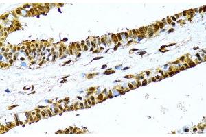 Immunohistochemistry of paraffin-embedded Human breast using NFkB p100 / p52 Polyclonal Antibody at dilution of 1:100 (40x lens). (NFKB2 抗体)