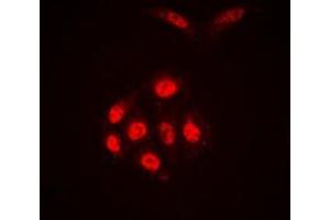 Immunofluorescent analysis of SAE1 staining in A431 cells. (SAE1 抗体  (Center))