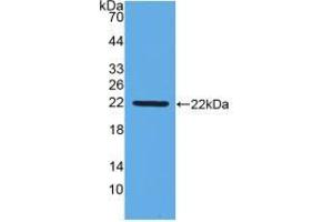 Western blot analysis of recombinant Chicken IFNb. (IFNB1 抗体  (AA 27-203))