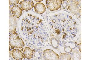 Immunohistochemistry (Paraffin-embedded Sections) (IHC (p)) image for anti-Solute Carrier Family 2 (Facilitated Glucose Transporter), Member 1 (SLC2A1) antibody (ABIN5997112)