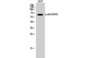 Western Blotting (WB) image for anti-T-Complex 1 (TCP1) (pSer455) antibody (ABIN3182583) (TCP1 alpha/CCTA 抗体  (pSer455))