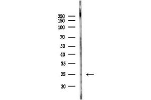 anti-PSMC3 Interacting Protein (PSMC3IP) (C-Term) antibody