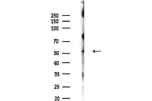 Western blot analysis of lysates from F10-LUC cells(heat-shock,45 min treatment), using MEF2C Antibody at 1/1000 dilution.