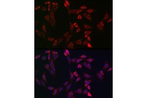 Immunofluorescence analysis of NIH-3T3 cells using Bid Rabbit pAb (ABIN3020687, ABIN3020688, ABIN3020689, ABIN1512634 and ABIN6213669) at dilution of 1:150 (40x lens). (BID 抗体  (AA 1-130))