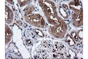 Immunohistochemical staining of paraffin-embedded Human Kidney tissue using anti-CAT mouse monoclonal antibody. (Catalase 抗体)