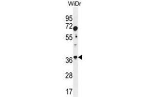 ALDOC Antibody (N-term) western blot analysis in WiDr cell line lysates (35 µg/lane). (ALDOC 抗体  (N-Term))