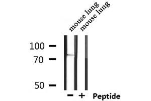 Western blot analysis of extracts from mouse lung, using SV2C Antibody. (SV2C 抗体  (Internal Region))